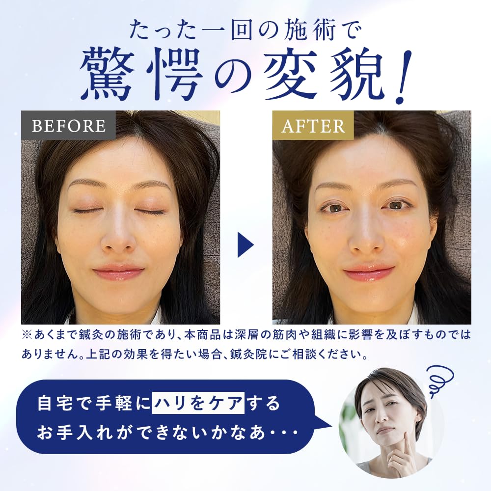 BiRyu Dermacharge Spot Cream BiRyu Aging Care Eye Cream Serum Needle Serum Intensive Care Microcurrent Rough Skin Dry Firmness Shine Retinol