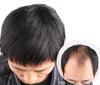 AISIHAIR Men's Short Wig, Hairpiece, Medical Wig, Black, Short, Breathable, Top Cover, 16*18cm