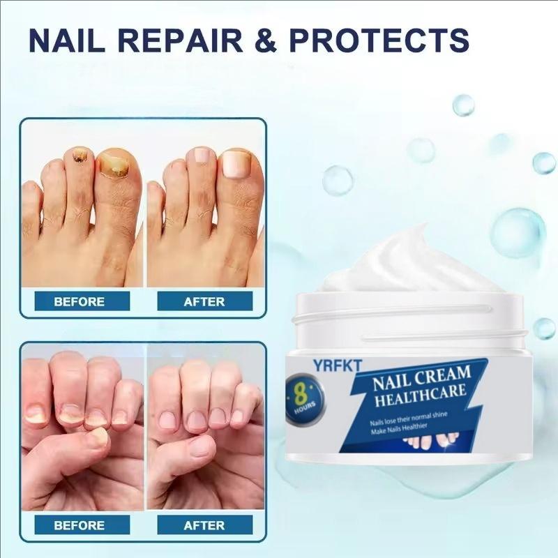 Nail Care Cream, Safe and Gentle for Repairing Nails On Hands, Feet, and Toes, Removing Nail Fungi, Repairing and Caring for Paronychia