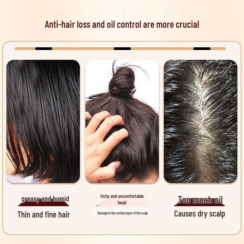 Bawang Anti-Hair Loss & Oil Control Shampoo