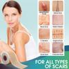 1 Roll Easy-Tear Silicone Gel Tape Roll - Medical Grade Wound Dressing, Sticky Bandage, Latex-Free, Adhesive, Soft Flexible