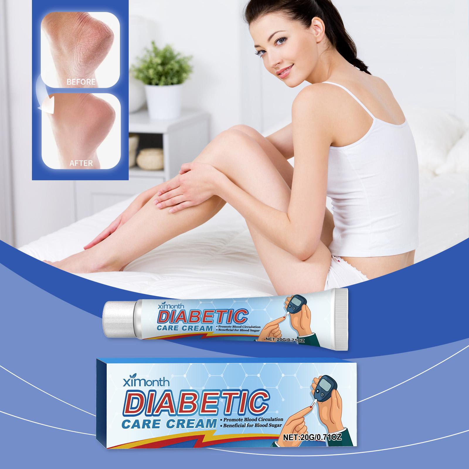 

Ximonth Body Cream Gentle Ingredients Moisturize Body Skin Dryness Relief Cream