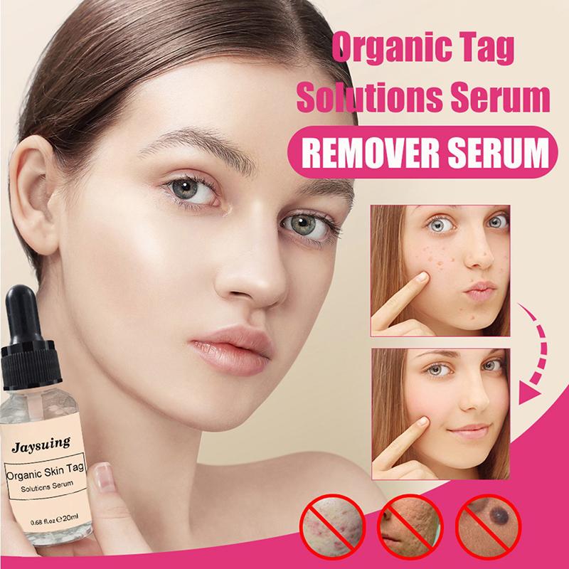 dark spot remover for skin