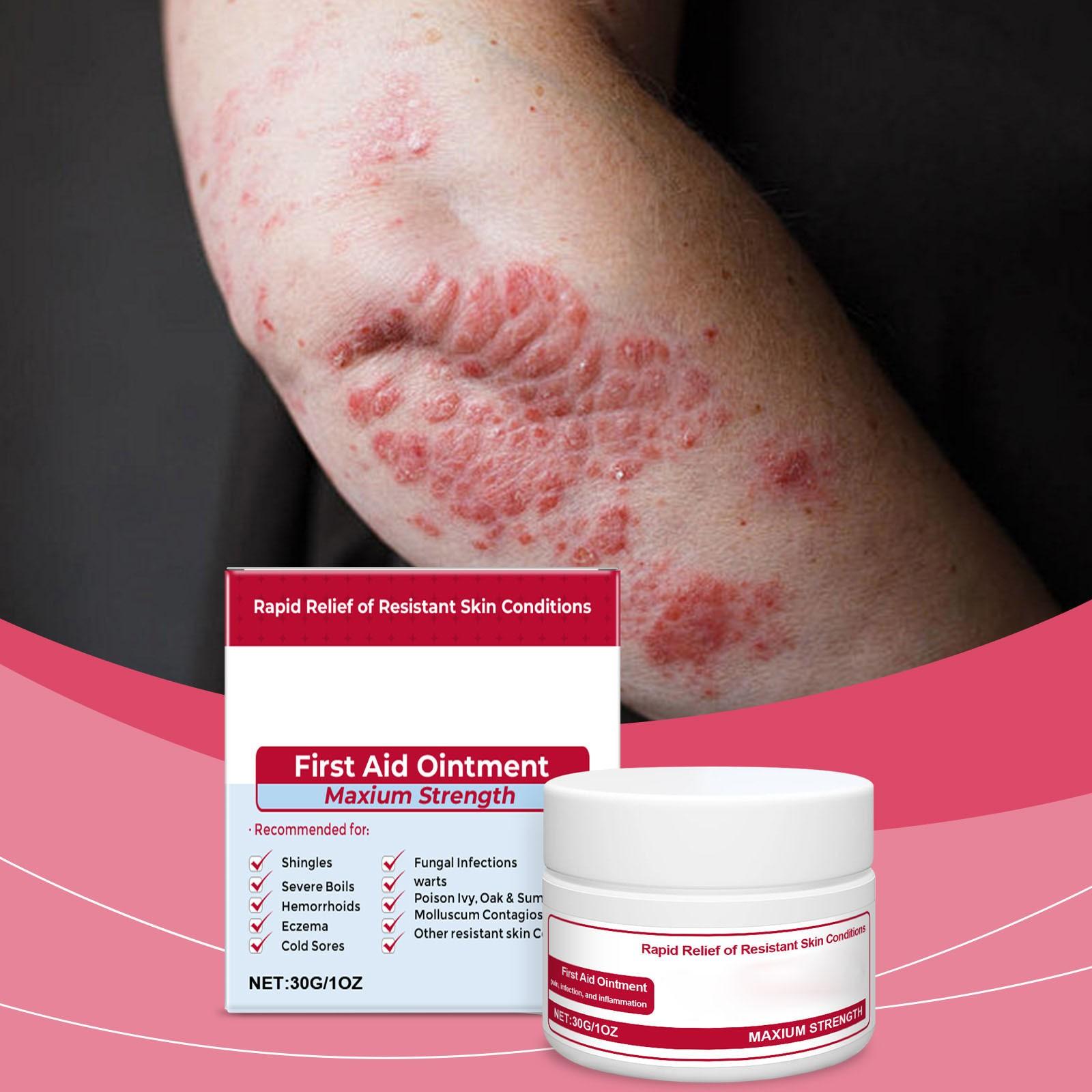 

Skin Care Cream, Gentle Skin Care And Moisturizing Skin Soothing Cream One Size