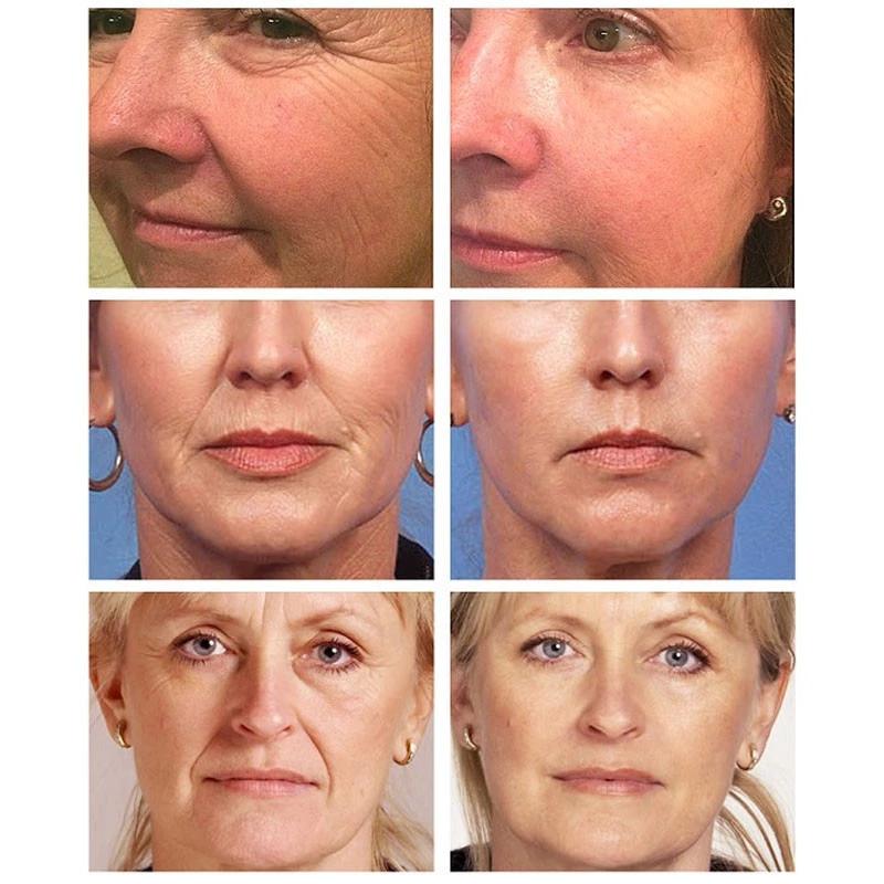 Sérum rétinol Anti-âge, collagène raffermissant, Essence faciale, élimine les rides, soulage les ridules, répare, resserre la peau