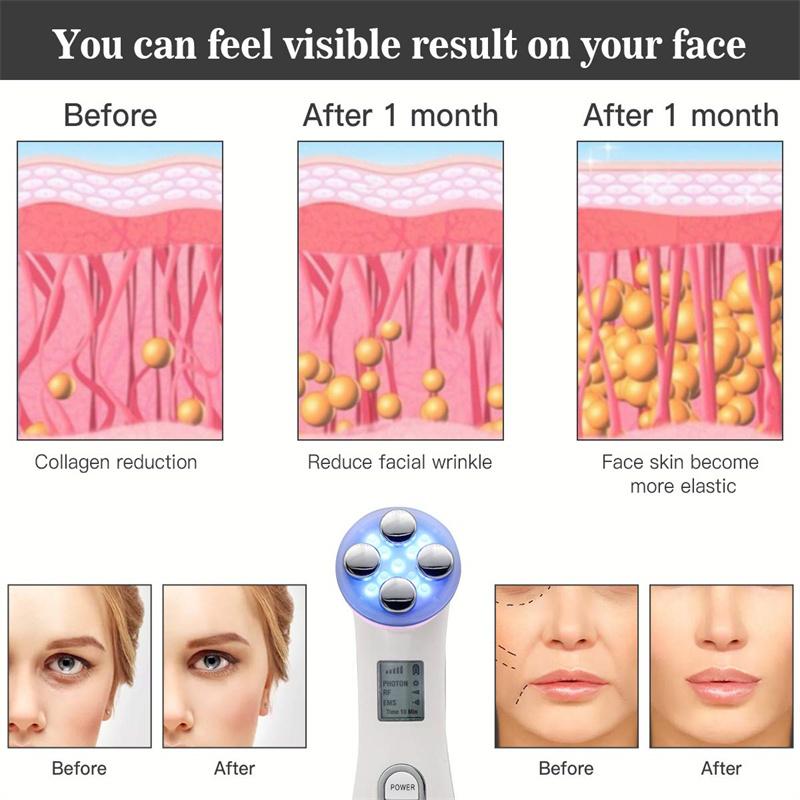 KinseiBeauty EMS LED fotonový masážní přístroj Mezoterapie Elektroporace RF radiofrekvenční přístroj pro péči o pleť obličeje Face Lift Tighten Beauty Machine