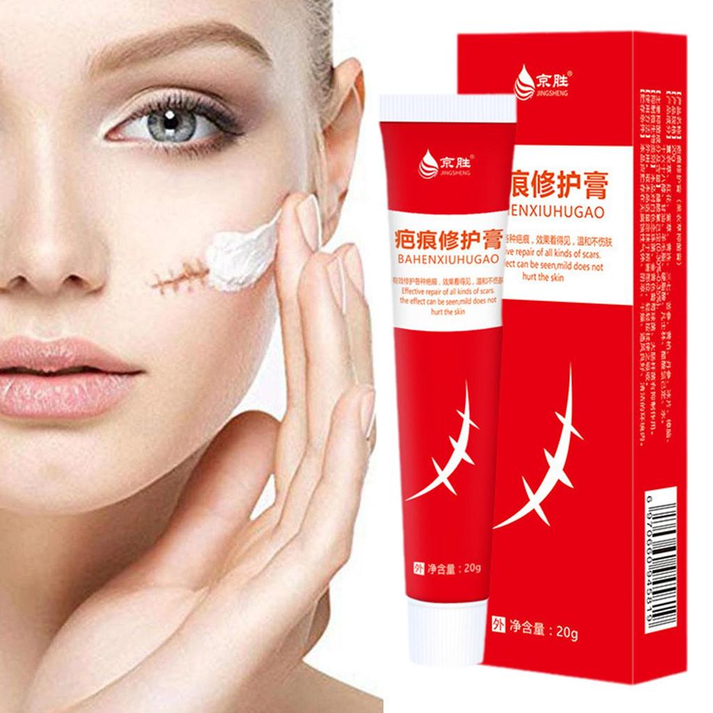 20 г крем для удаления шрамов от акне, хирургическое удаление растяжек, гель для кожи лица, отбеливающий пигментацию тела, Sm U4P9