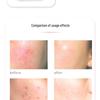LED Facial Rejuvenation Device: Light & Vibration Therapy Mask for Skin Tightening
