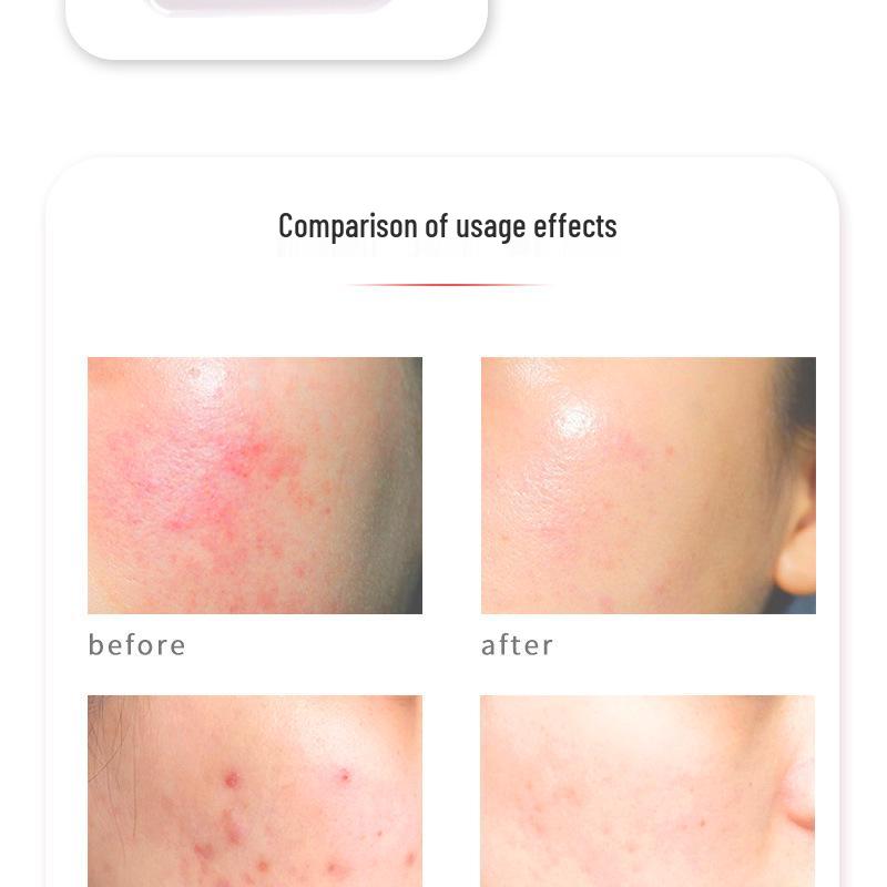 LED Facial Rejuvenation Device: Light & Vibration Therapy Mask for Skin Tightening