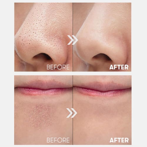 VTCOSMETICS Deer Blackhead Cleaner 100ml Pore Care Blackheads Horny Care Blackhead Skin Care Korean Cosmetics