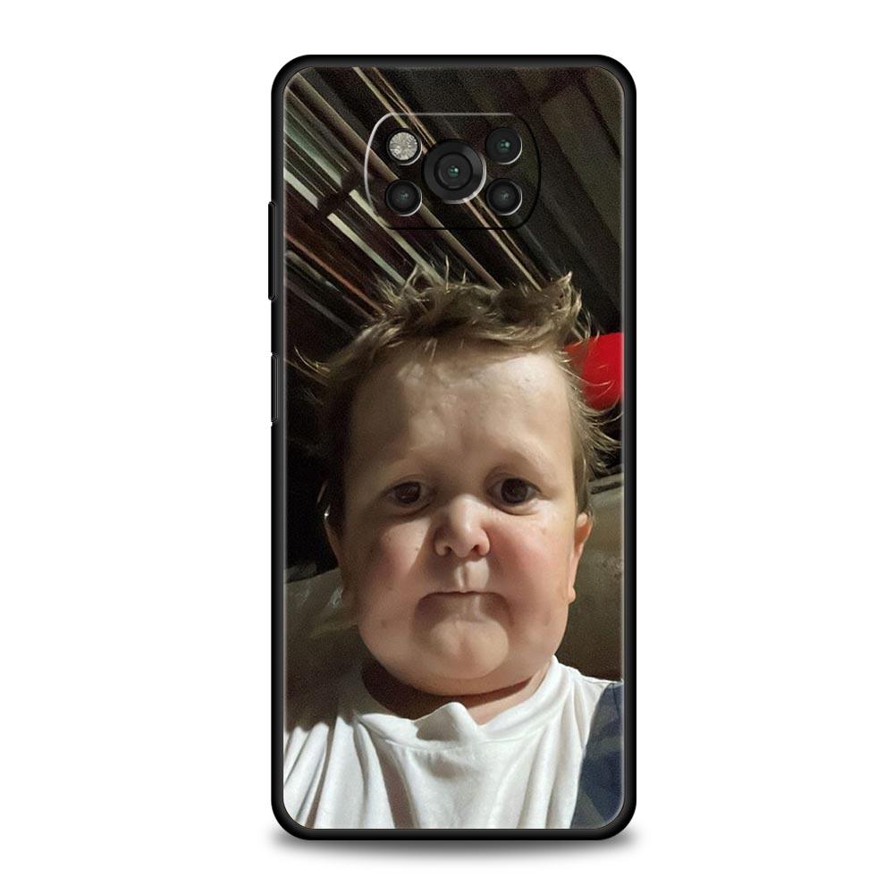 Funny Hasbulla Phone Case For Xiaomi Mi Poco X3 NFC M3 F4 F3 M4 X4 Pro 5G Note 10 12 Lite 11 11T 10T 11X 13 12T Pro 9T Cover