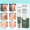 Crème de Réparation pour Ongles pour des Ongles Sains et Forts et Soin Doux des Pieds 20g Pour le Traitement des Ongles Endommagés