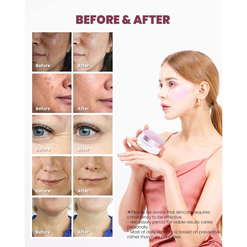 KSECRET Retinol Advanced Regenerating Eye Gel Patches