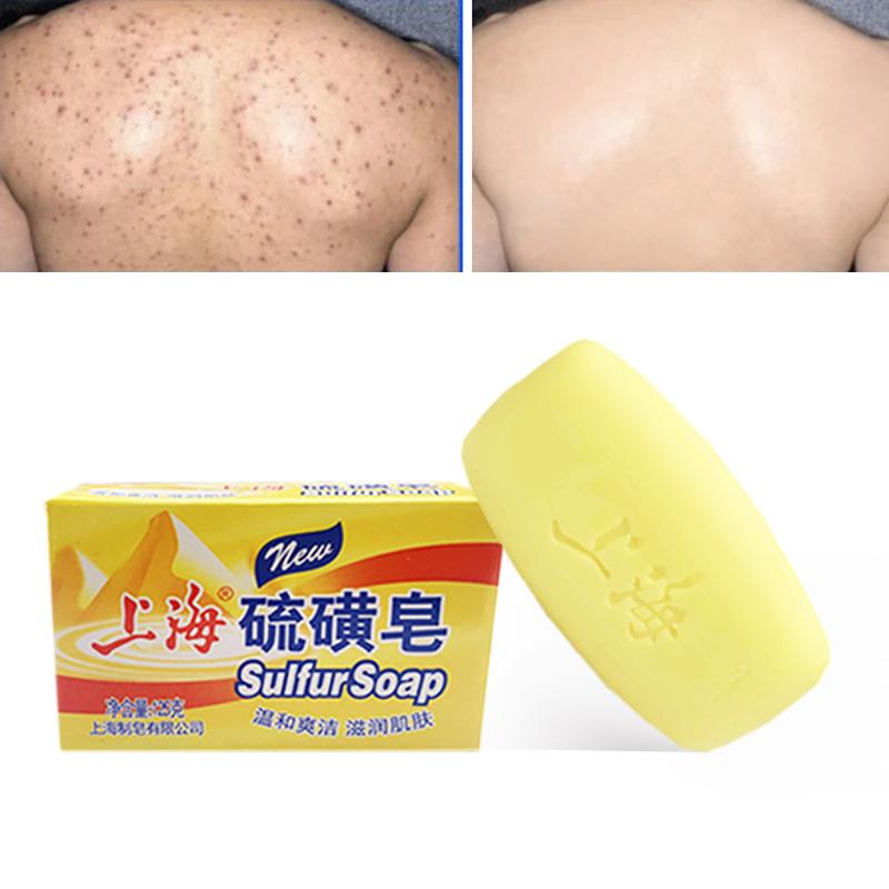 Savon au soufre nettoyant pour le visage Savon au soufre de Shanghai Contrôle du sébum Adoucissant à la kératine Barre de savon obstruant les pores Sûr Hypoallergénique Pour les peaux grasses