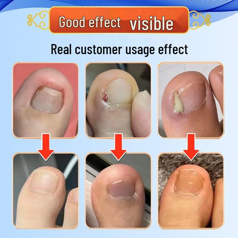 Miyamoto Musashi Foot & Nail Care