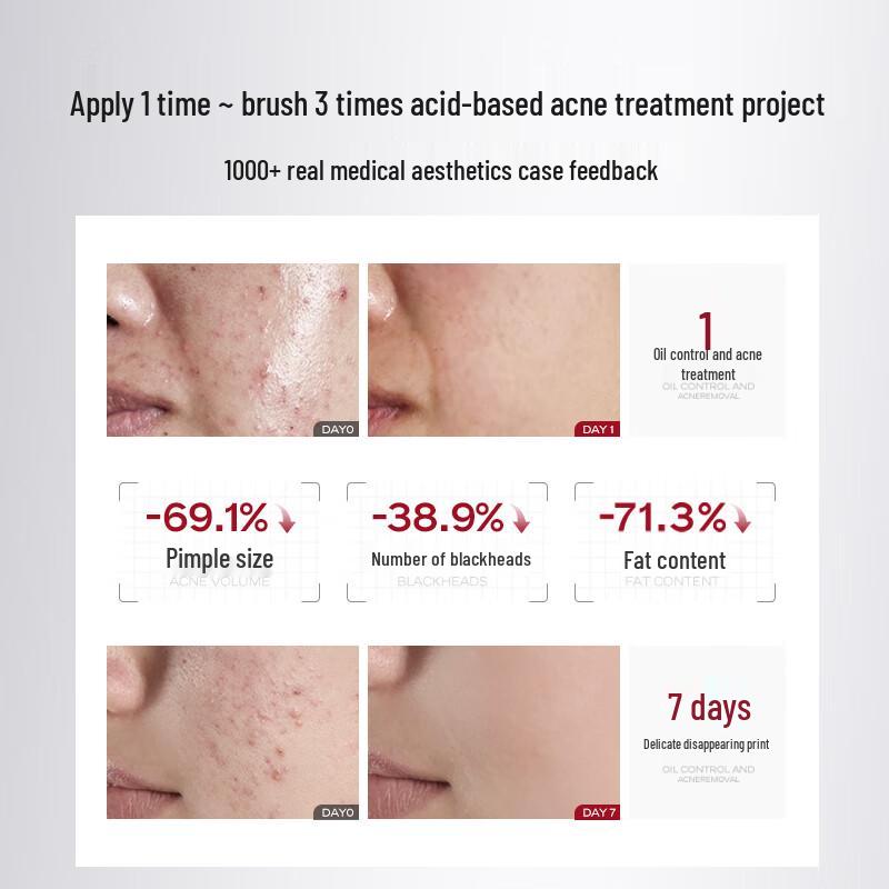 HURMEVKOR Salicylic Acid Acne Treatment Pads