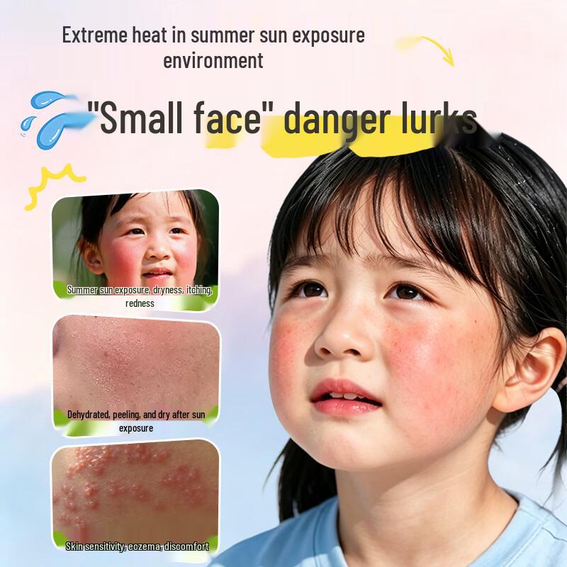 Baby Blaze Soothing After-Sun Repair Cream for Kids