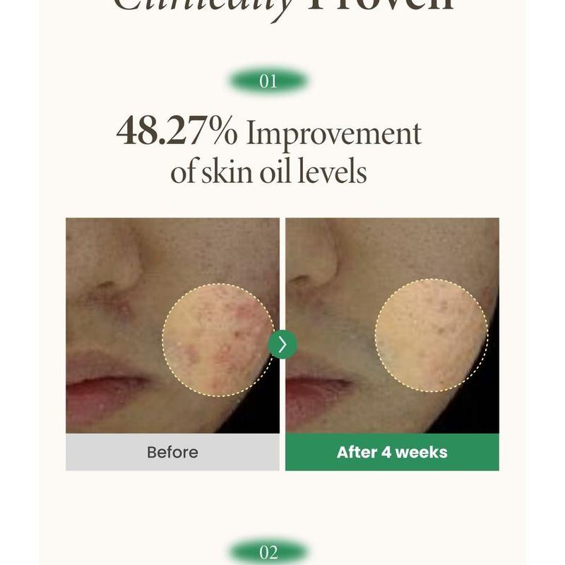 AXIS - Y - Spot The Difference Blemish Treatment