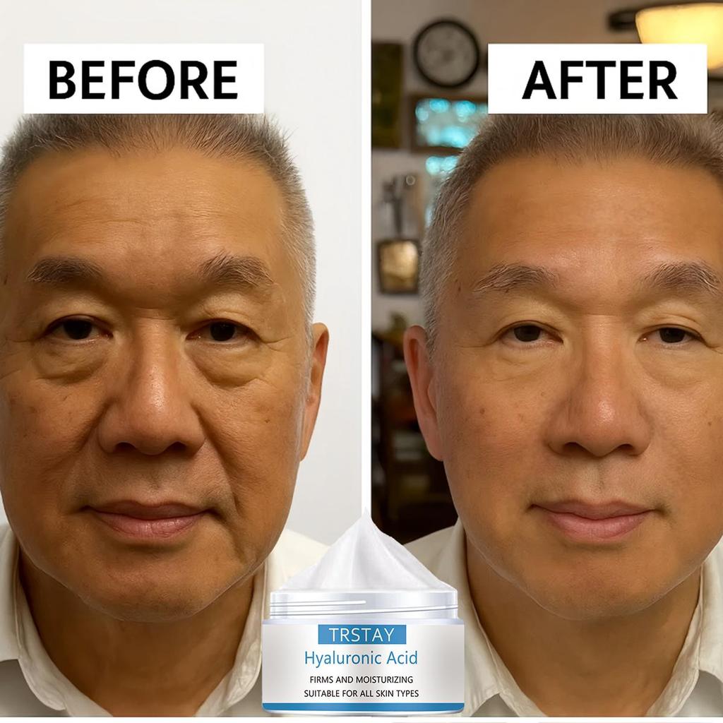 Brightening Cream fukter, er glatt og delikat, skånsom og ikke-irriterende, reduserer fine linjer, fukter huden og forbedrer skadet hud