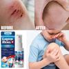 Liquid Band-Aid Waterproof First Aid Liquid Bandage Disinfecting Hemostasis Spray-on Film Wound Care Spray Protects Wounds