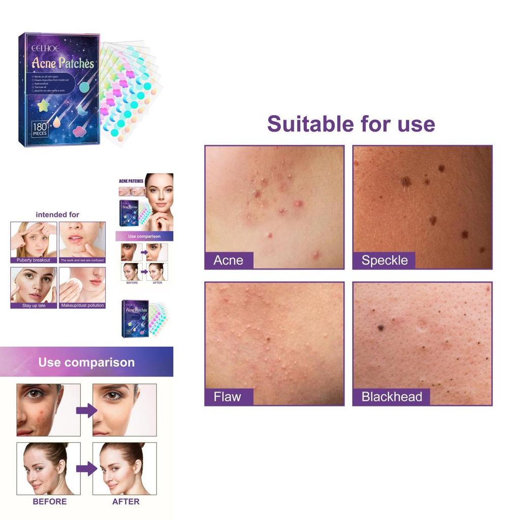 Eelhoe Pimple Patches For Effective Skin Repair And Acne Spot Treatment With 180 Pieces For Clear Complexion