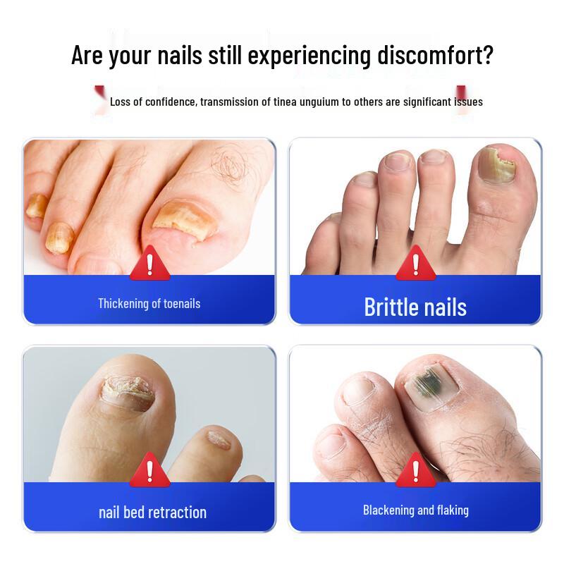 HEBST Toenail Fungus Treatment Liquid