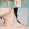 2025 Neck Lifting Tapes, Invisible Anti-Wrinkles Neck Patch Neck Rescue Instant Correcting Strips (4pcs neck bands, 20pcs replacement tapes)