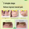 Glue-Free Natural Ingrown Toenail Corrector Stickers