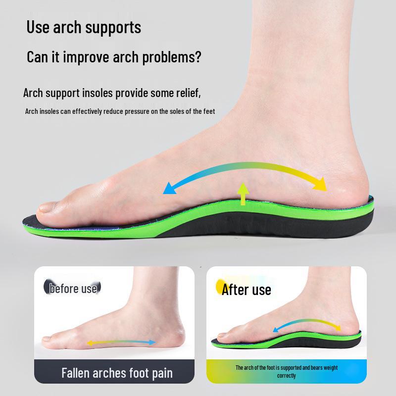 Flat Foot Correction Insoles: Arch Support for Flat Feet, Leg Shape Calf Eversion, XO Leg Correction.