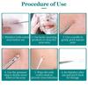 8-Piece Acne Extraction Tool Set In Stainless Steel Box, Professional For Spas And Beauty Salons (Includes Free 10Pcs Pad)