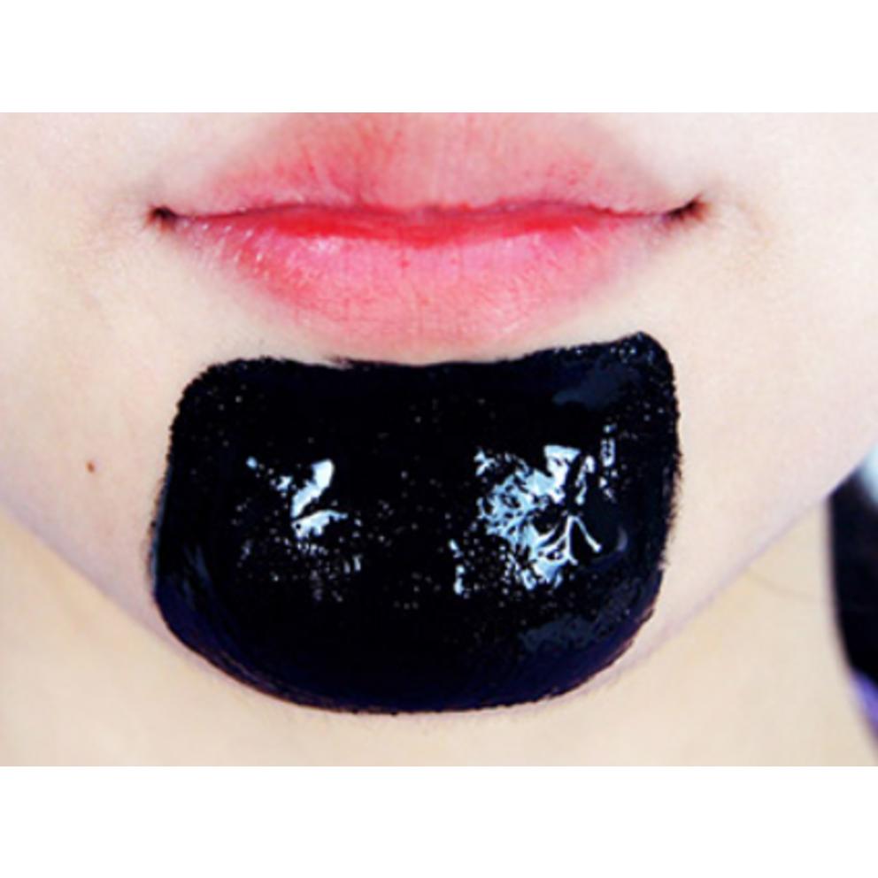 [Lirikos] All Kill Mitesserentferner Nasenmasken-Packung 40ml
