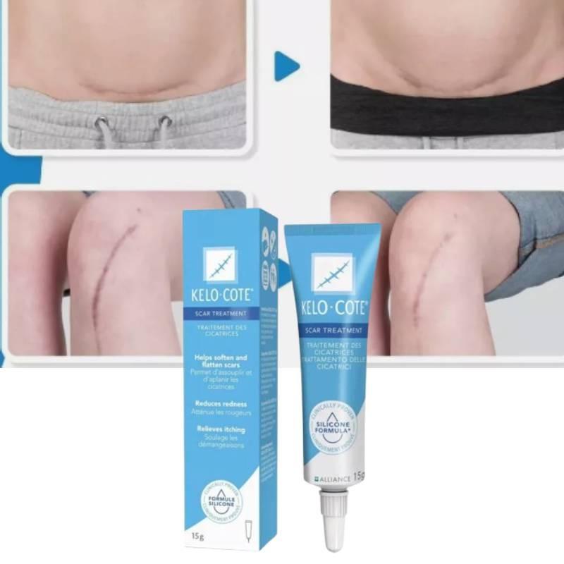 Advanced American Bakelo Scar Gel 15g For Effective Scar Repair And Hydration