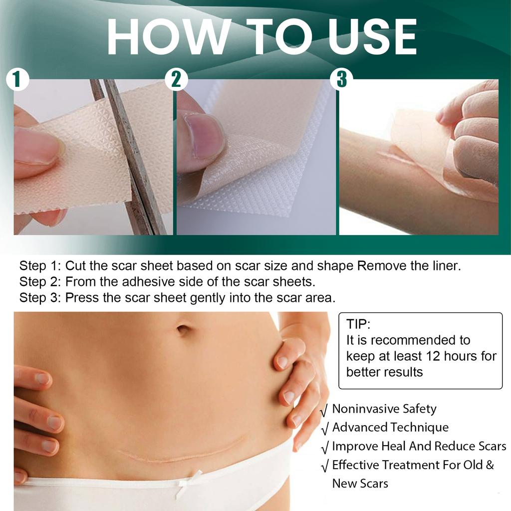 EELHOE 1 Roll Silicone Scar Removal Sheets for C-Section Postoperative Skin Colored Invisible Beauty Tape