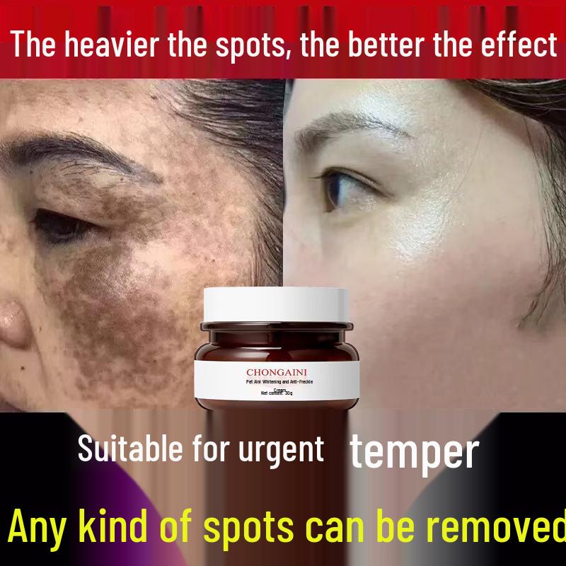 Highly Effective Brightening Cream: Fade Age Spots, Freckles, Melasma, and Pigmentation