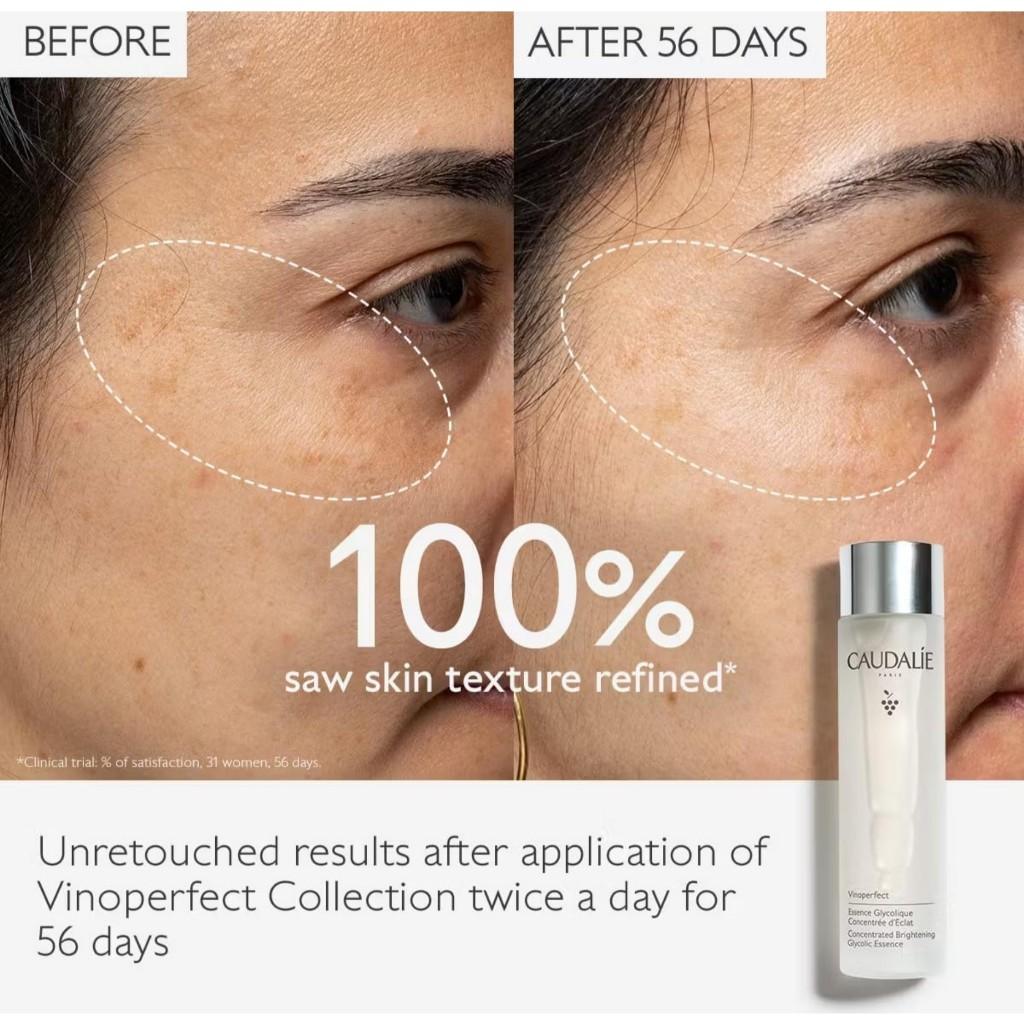 CAUDALIE Vinoperfect Essenza Glicolica Illuminante Concentrata 100ml, 150ml