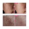 TOSOWOONG Arbutin 7% Tranexamic Acid 4% Cream 50ml Brightening K-Beauty