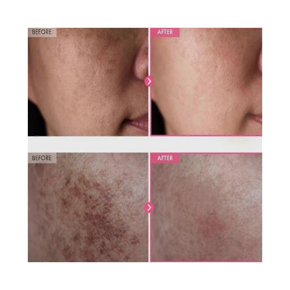 TOSOWOONG Arbutin 7% Tranexamic Acid 4% Cream 50ml Brightening K-Beauty