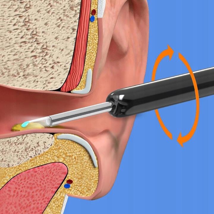 Smart Otoscope Camera Ear Cleaning Wax Wifi Hd Application Endoscope