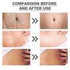 Wiieey Butter Moisturizing Cream Lightens Stretch Marks Repairs Skin Elasticity Firms & Smoothes