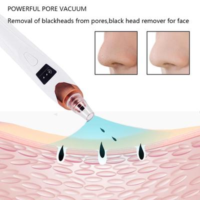 Outils de Soin du Visage Nettoyeur d'Acné Aspirateur à Points Noirs pour le Visage et le Nez Outil de Nettoyage Profond du Visage Beauté Maison  lesen