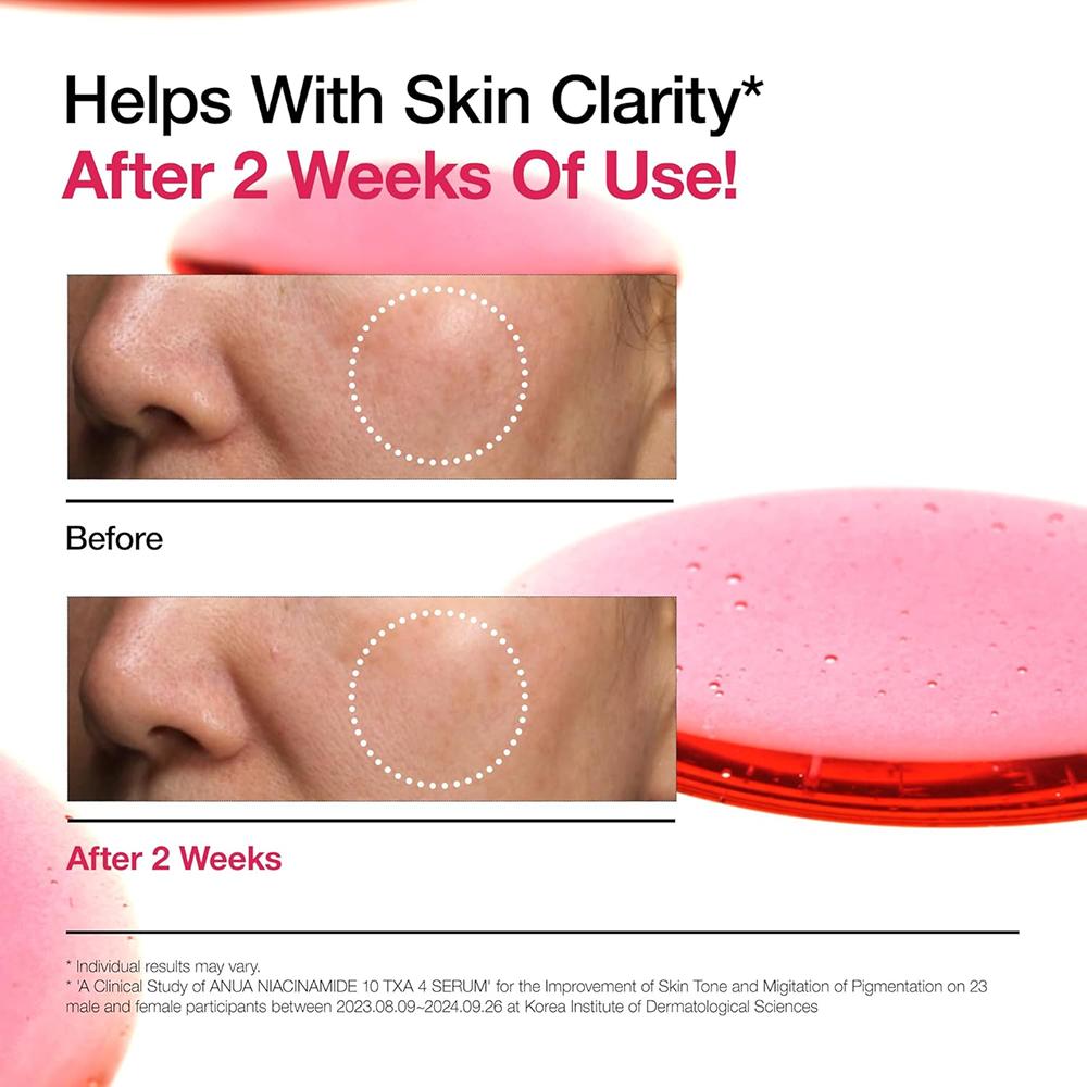 Anua Niacinamid 10+ TXA 4 Serum 30ml - Koreanische Hautpflege