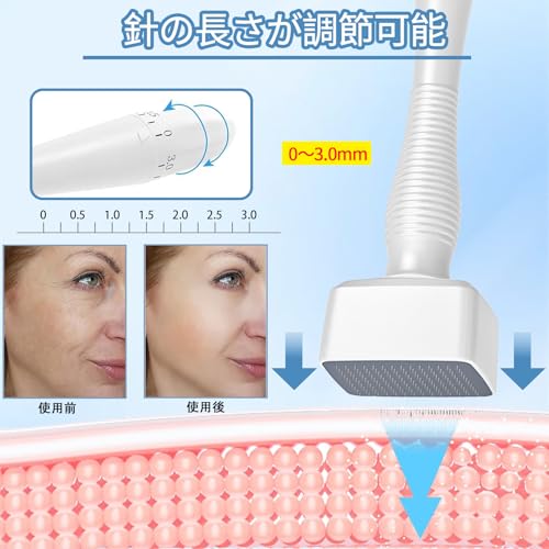 SrDiot Derma Stamp, 140 Needles, Adjustable from 0-3.0mm, Derma Roller for Cosmetic Acupuncture and Microneedling, for Skin Rejuvenation, Scalp Remova