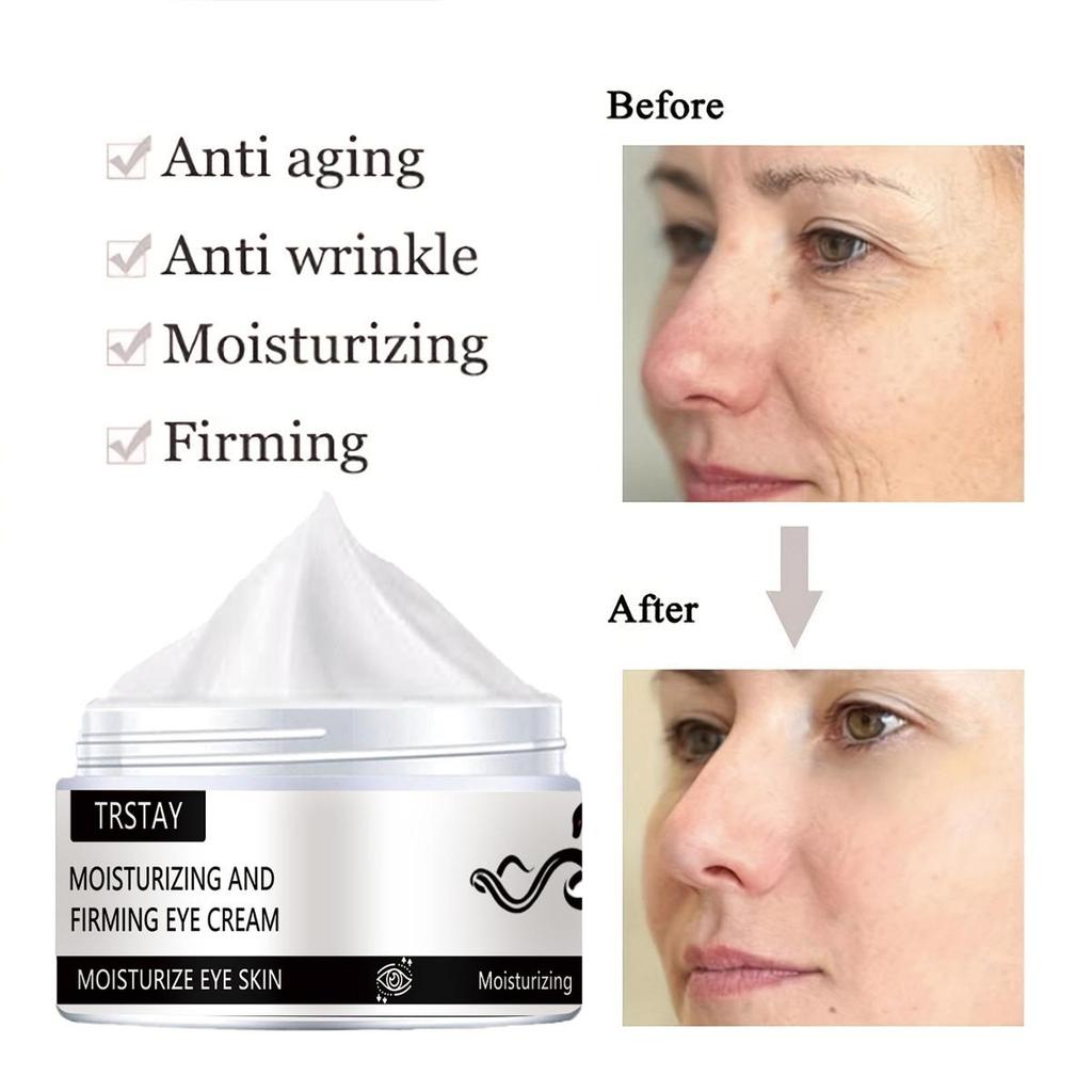 Bělící oční krém zvýrazňuje pleť kolem očí, opravuje poškozenou pleť, rozjasňuje a hydratuje pomocí hydratačního krému