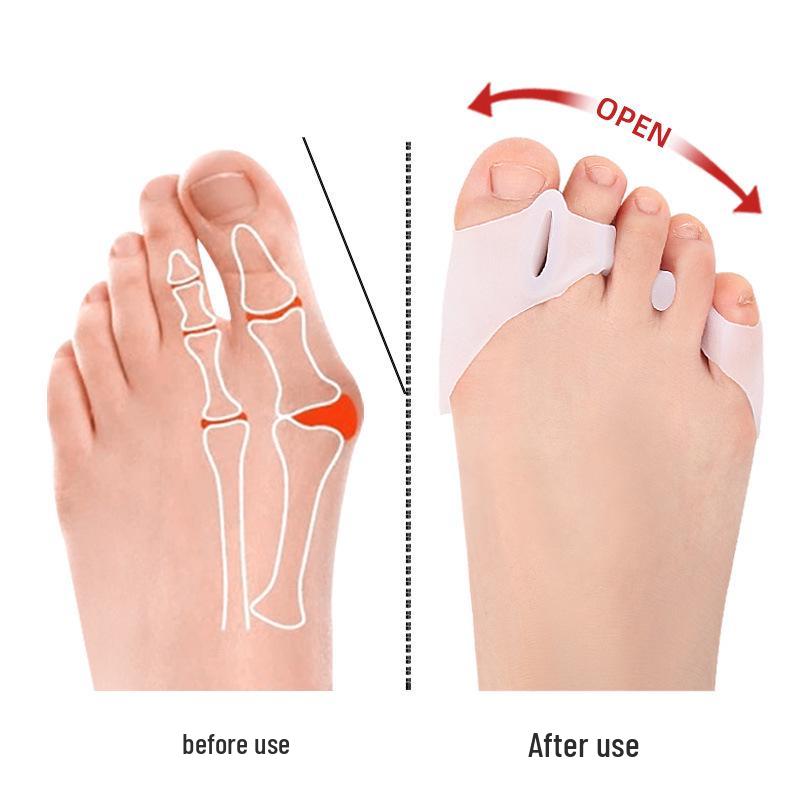 Toe Corrector Separator Pad for Bunion Relief, Pinky Toe Inversion Protector, Wearable In Shoes