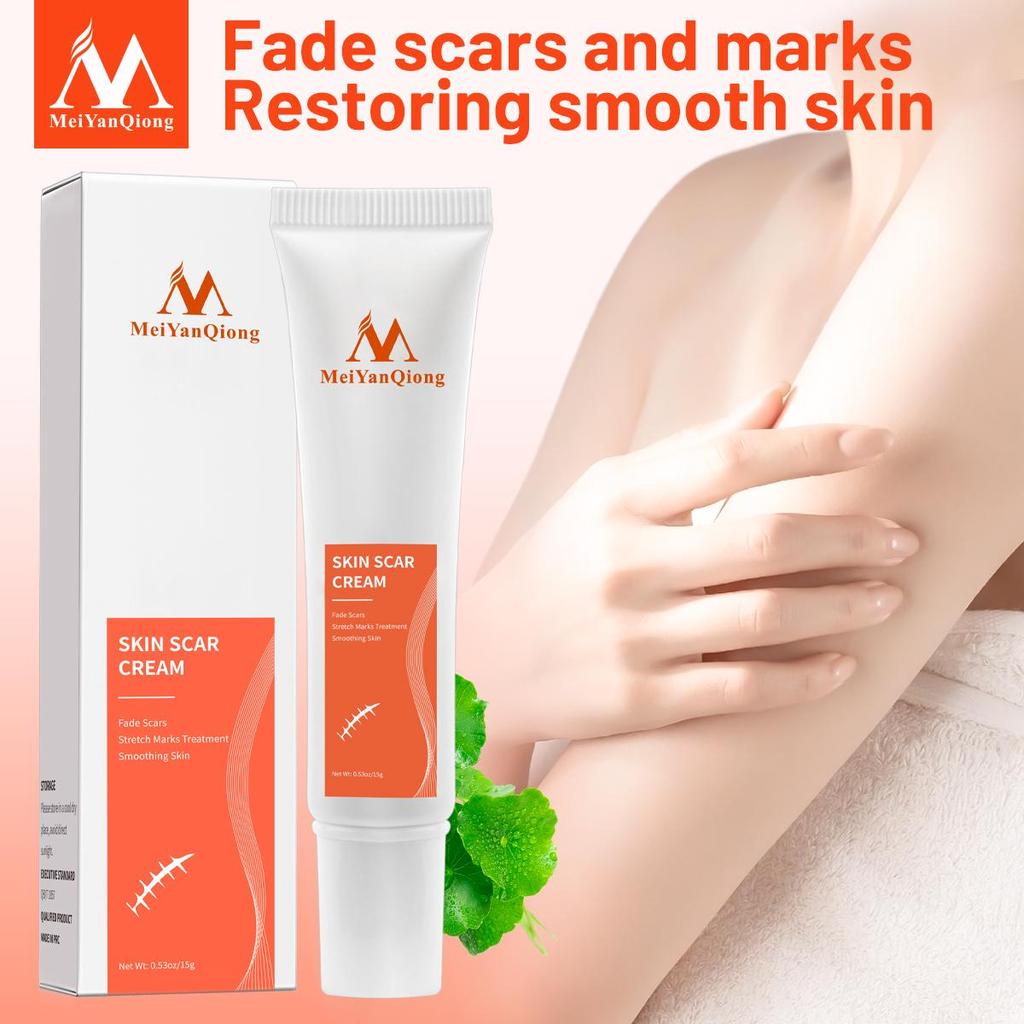 Acne Removal Cream Skin Repair Face Cream Acne Spots Acne Blackhead Whitening Cream