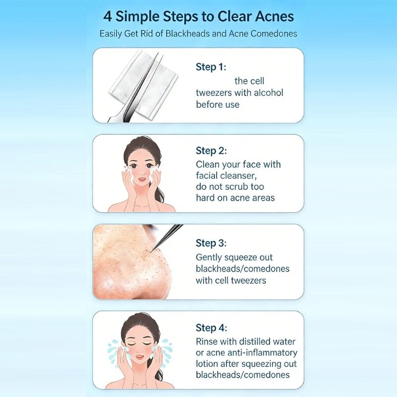 Professional Stainless Steel Blackhead Extractor Set Of 7 Pieces For Deep Pore Cleaning And Skin Cares