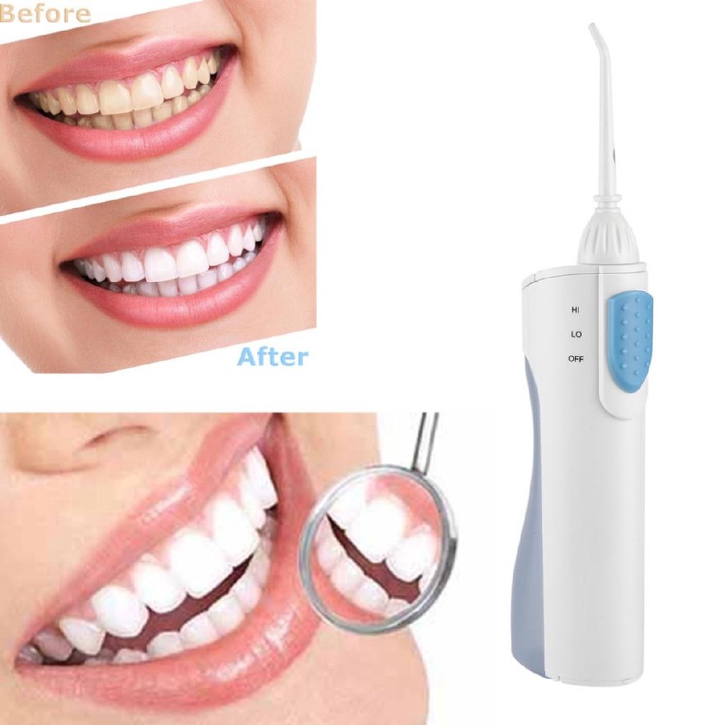 New Portable Oral Irrigator Water Dental Flosser SPA Floss Water Jet Toothbrush Teeth Cleaning Machine
