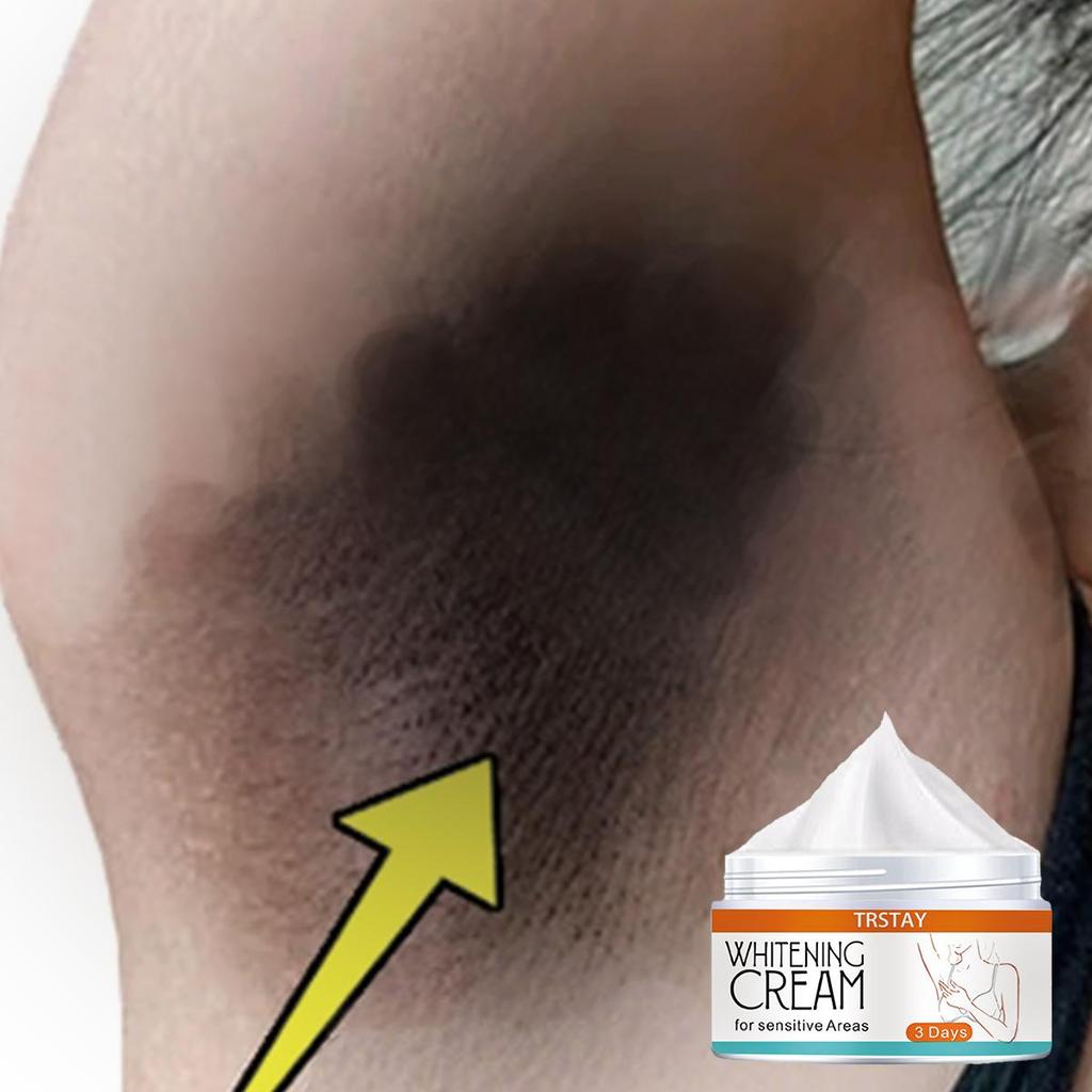 5G/15G/30G/50G/TRSTAY Women's Private Body Whitening Cream Reduces Underarm Odor