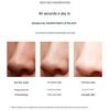 Visual Facial Blackhead Removal Instrument Pore Cleanser Blackhead Sucker  Skin Care