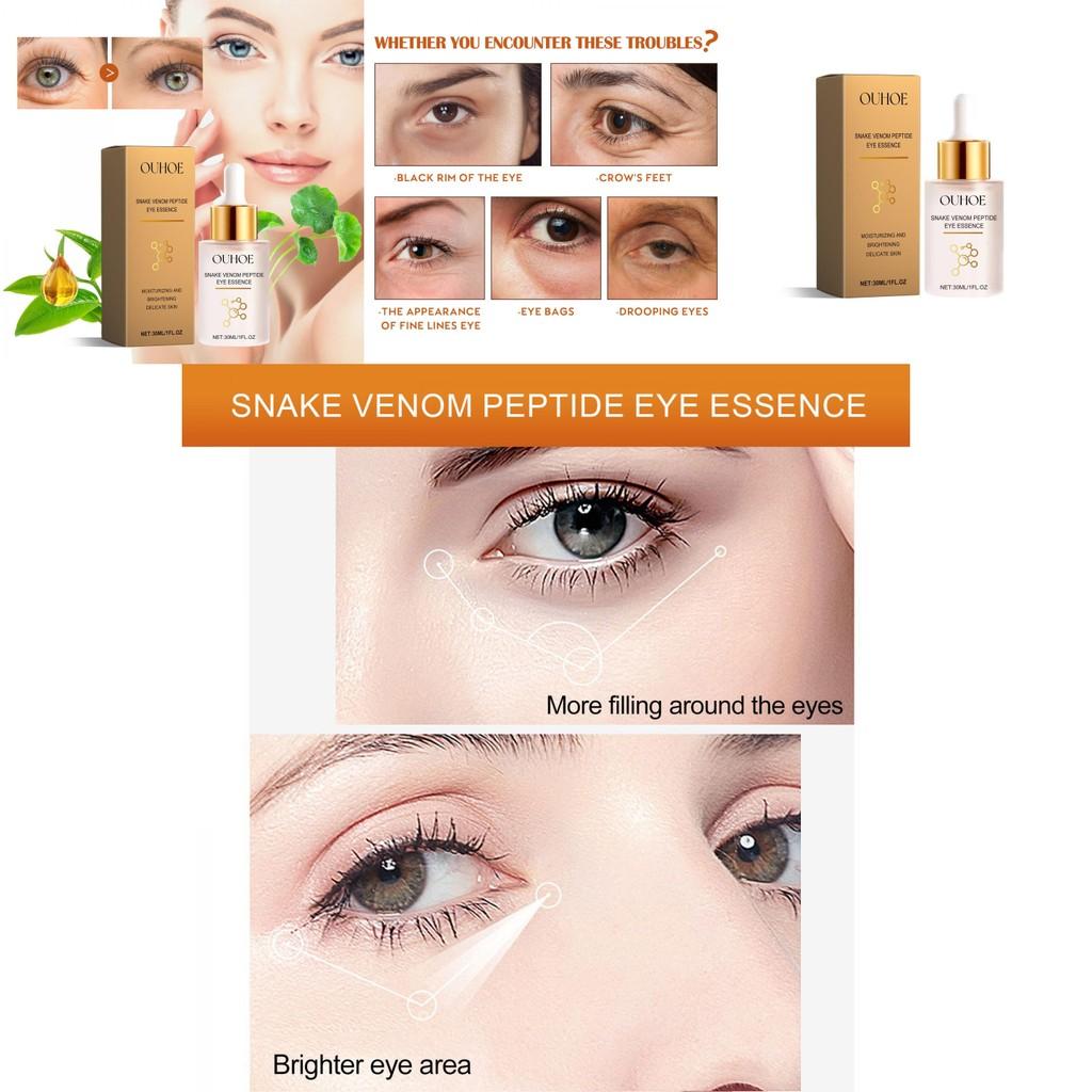 Ouhoe Anti-wrinkle Eye Serum 30ml For Firm Skin Reduces Fine Lines And Dark Circles